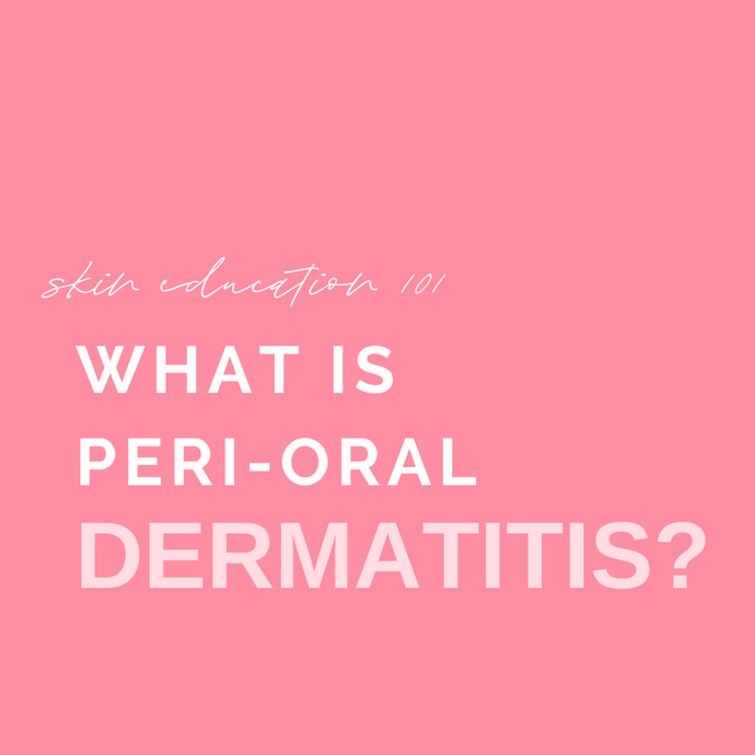 Dealing with Peri-Oral Dermatitis? Read this